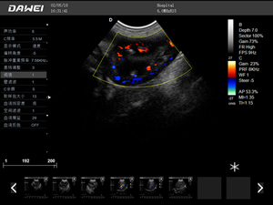 S8筆記本式獸用彩超機(jī)-寵物b超機(jī)掃描圖