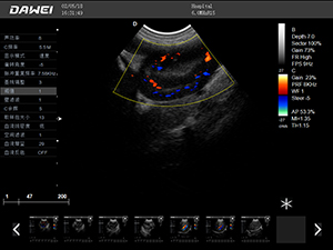 S9推車式獸用彩超機-寵物b超機掃描圖