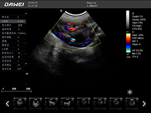 S9獸用彩超機檢查圖