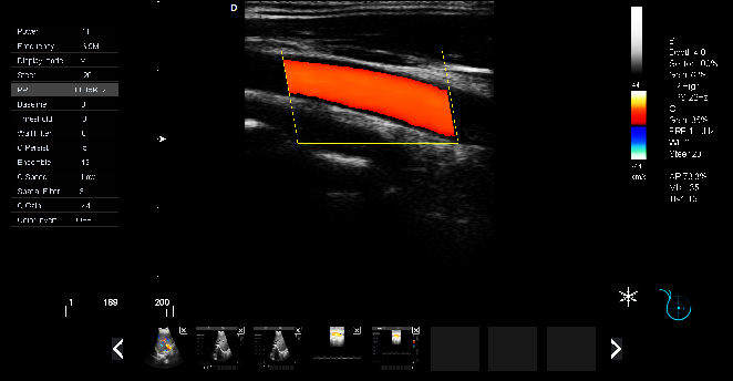 P5-VET便攜獸用彩超機頸動脈檢查圖